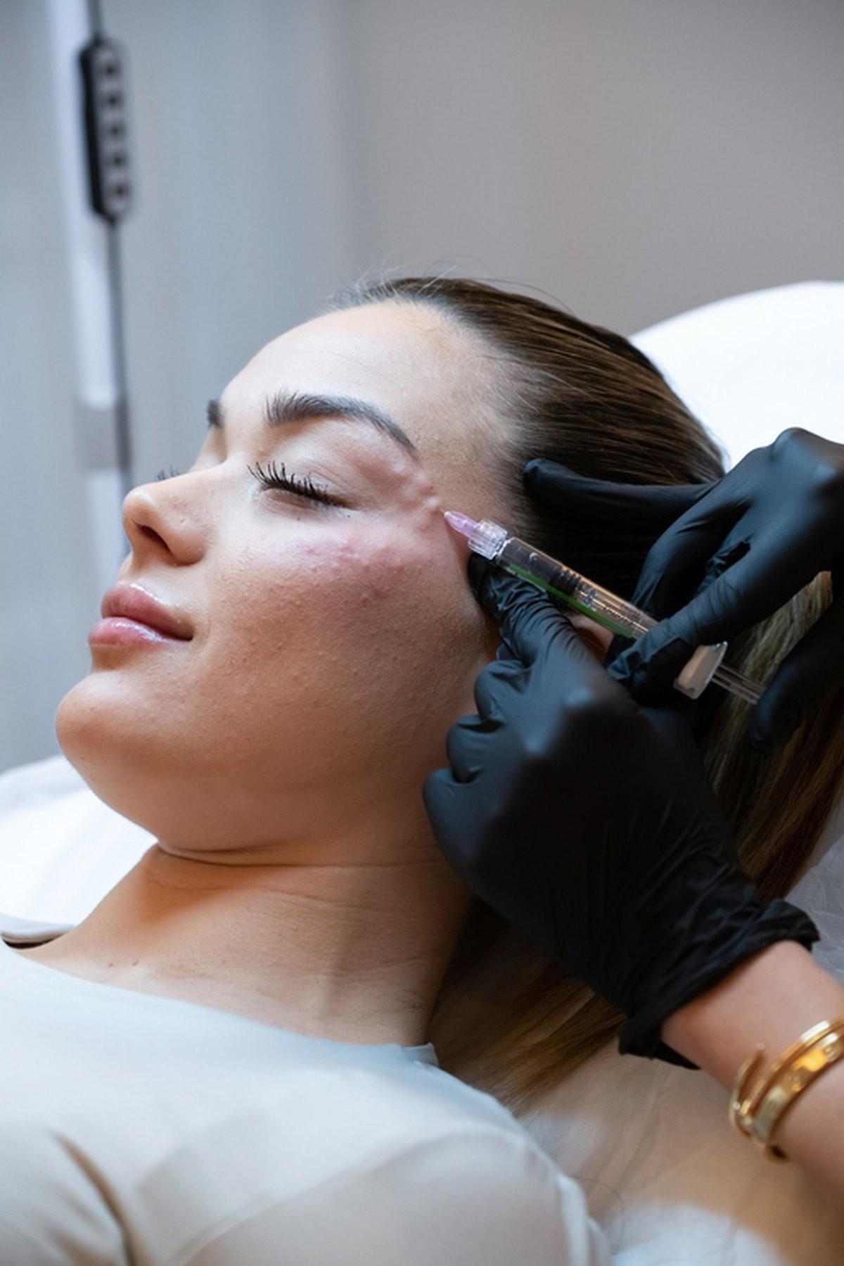 Polynucleotide treatment at Sage & Sol Skin Lab